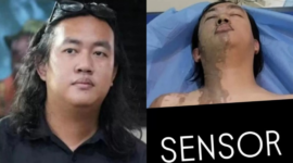 Pelaku Penyiram Air Keras ke Aktivis KontraS