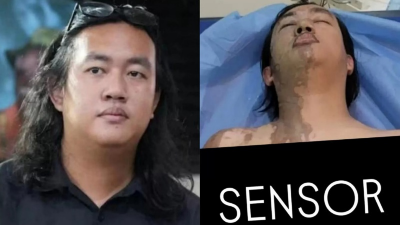 Pelaku Penyiram Air Keras ke Aktivis KontraS